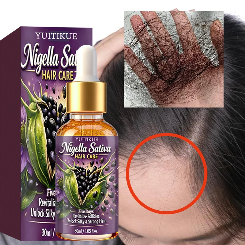 YUITIKUE Nigella Sativa Hair Care Oil | 5 Days Formula To Revitalize Follicles | For Silky, Strong & Healthy Hair 30ml