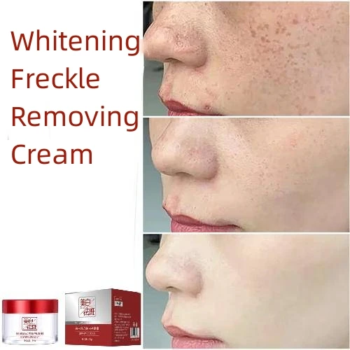 Effective Whitening Freckle Cream Remove Dark Spot Face Cream Removal Melanin Melasma Lighten Brighten Skin Care Korea Cosmetic