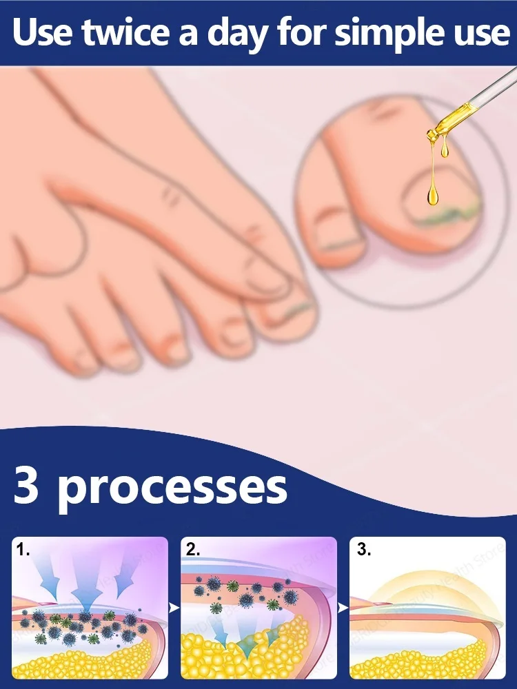 ชุดเครื่องมือดูแลเท้า ทำเล็บมือเล็บเท้า สีเทา แพ็คเกจเครื่องมือ ขายดีในปี 2025