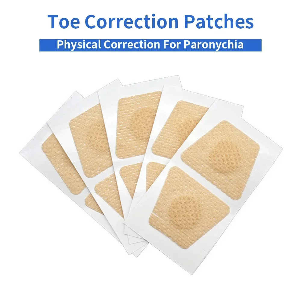 Ingrown Toenail Correction Tool Nail Filling Pad Ingrown Toe Nail Treatment Elastic Patch Straightening Clip Brace Pedicure Tool