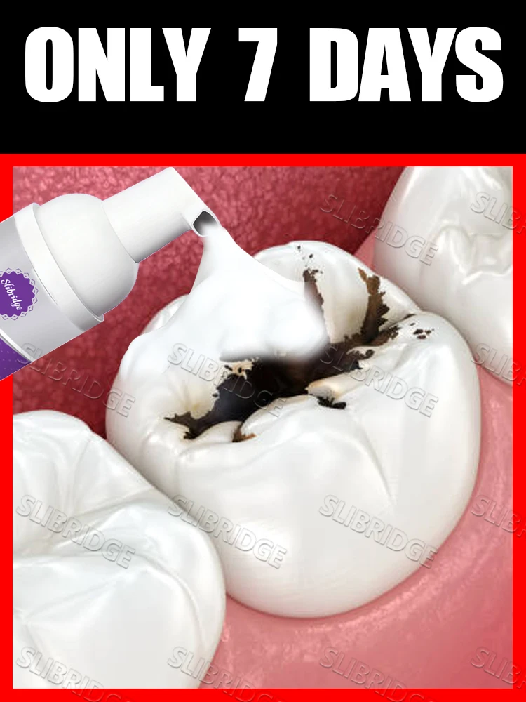 2025 موس التنظيف يحل مشاكل مختلفة أداة العناية داخل الفم التالفة المتغيرة