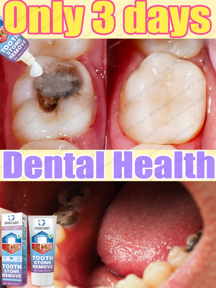 

99% людей отремонтовано, очищает зубы и удаляет темные пятна.