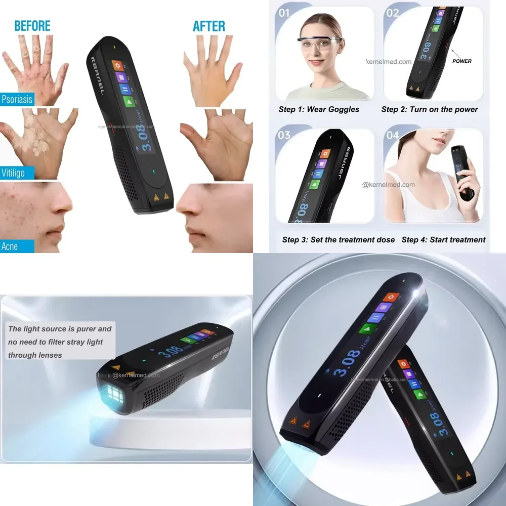 

CN-308P Mini Excimer Pen High Power 308nm UV for Kernel Electric Power Source for Vitiligo & Psoriasis Treatment