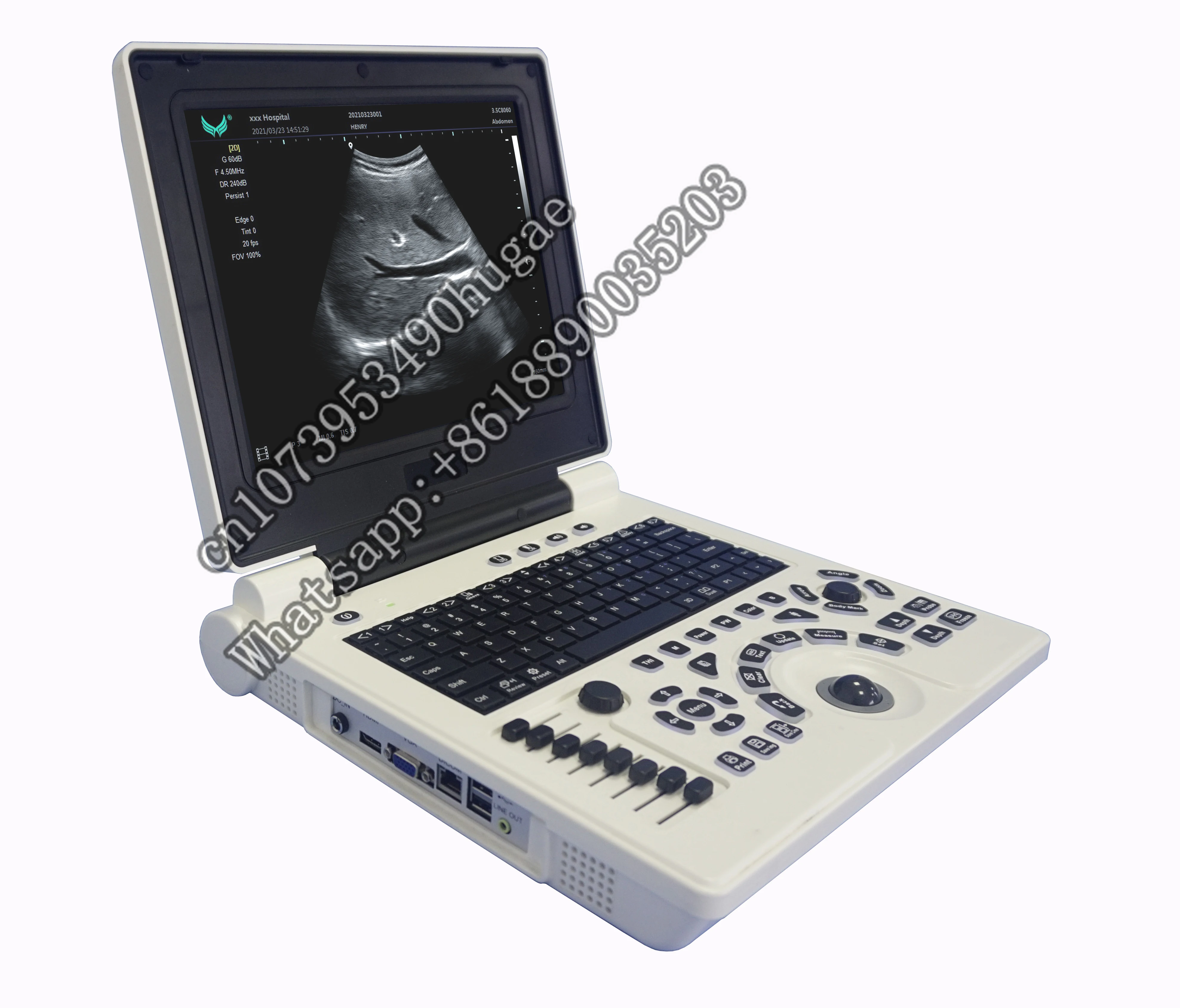 New P20 laptop B/W ultrasound scanner with PW/ IMT function