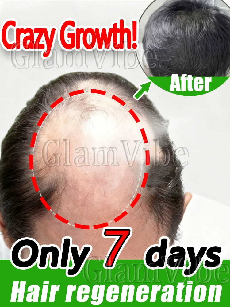 Sᴛʀᴏɴɢ ʀᴏᴏᴛ sᴜᴘᴘᴏʀᴛ,resulting in voluminous and layered h̶a̶i̶r̶.̶