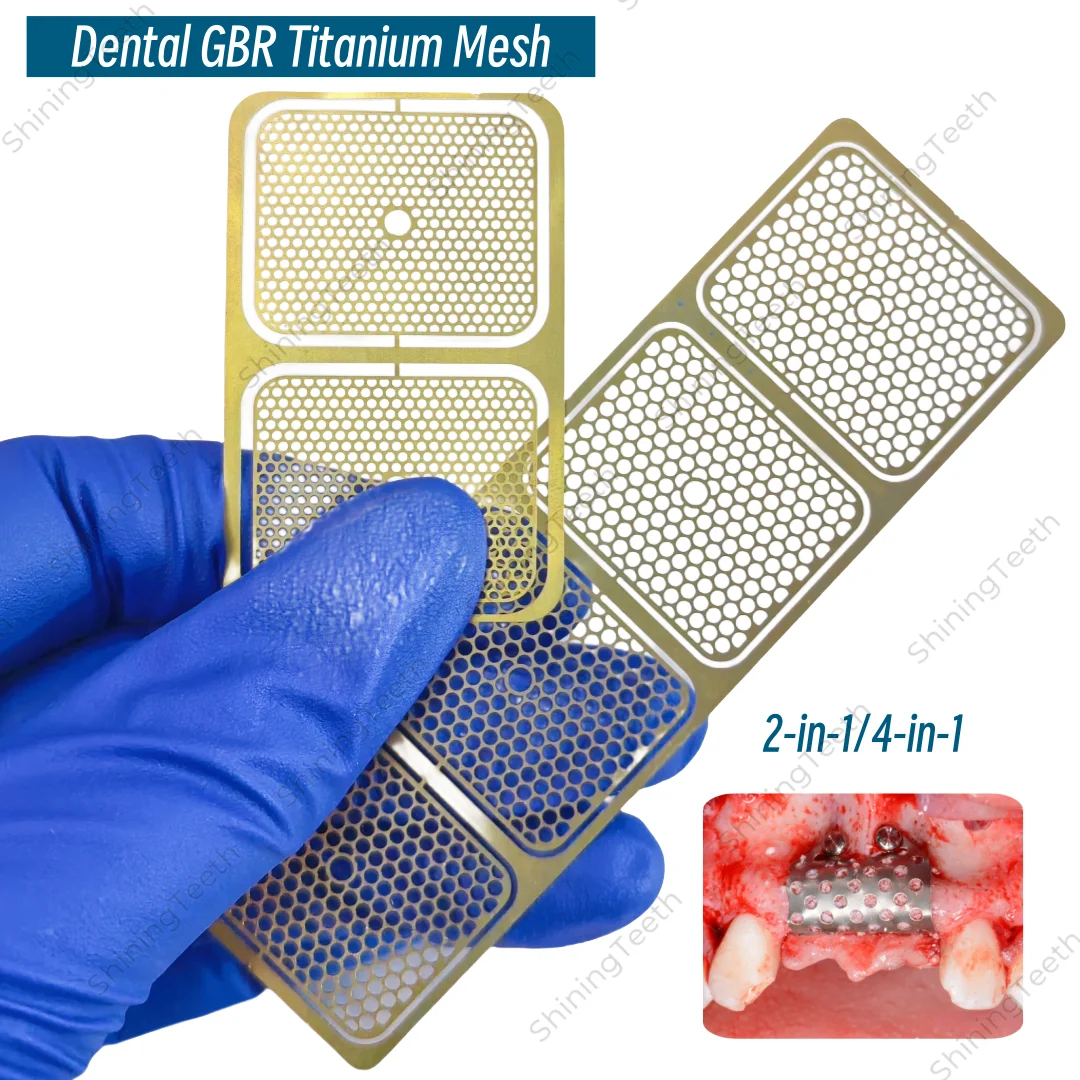 Dental Implant Titanium Mesh GBR Flexible Bone Regeneration Barrier Membrane Safe Titanium Plate