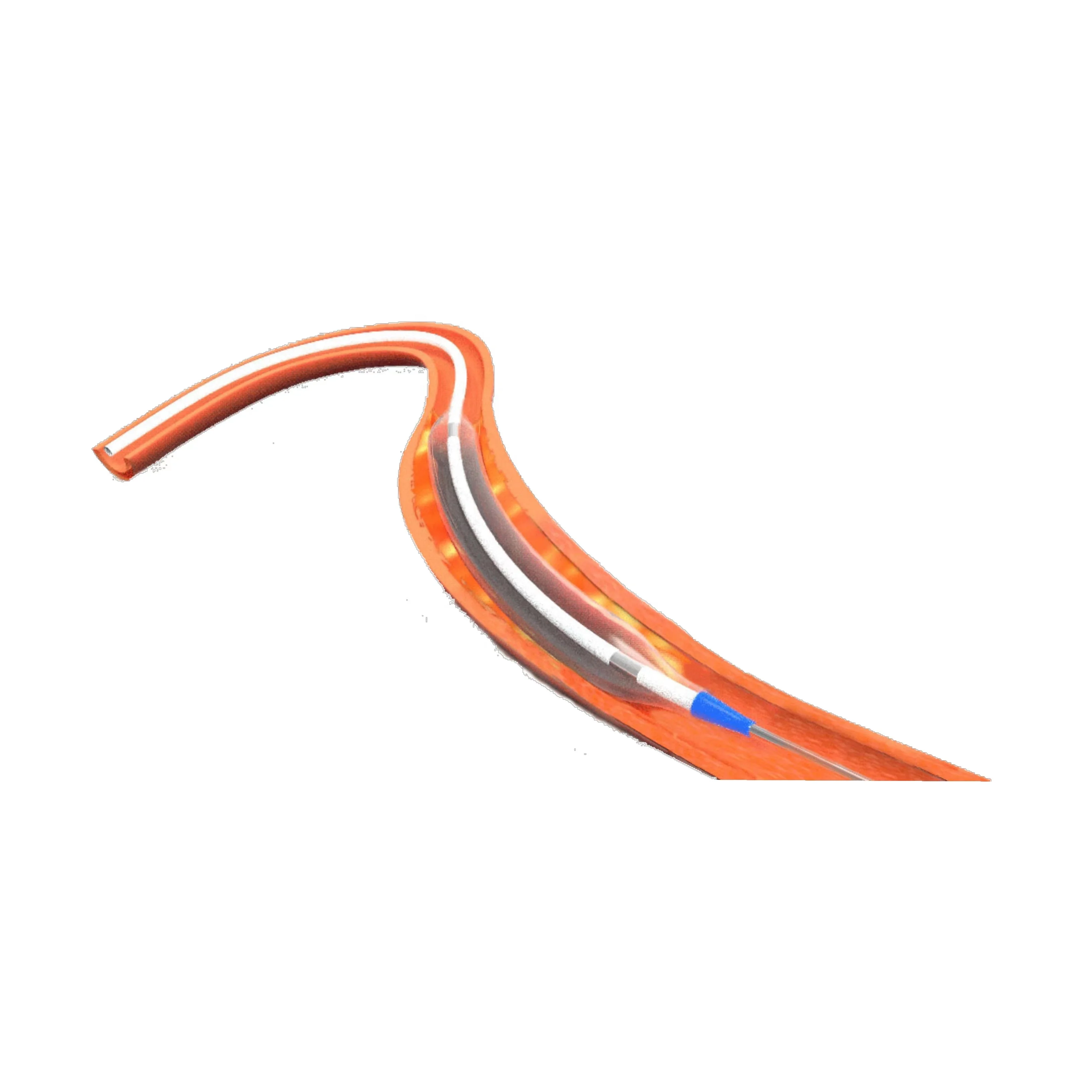 Lepu Medical Tadpole Semi-compliant Disposable Balloon Dilatation Catheter