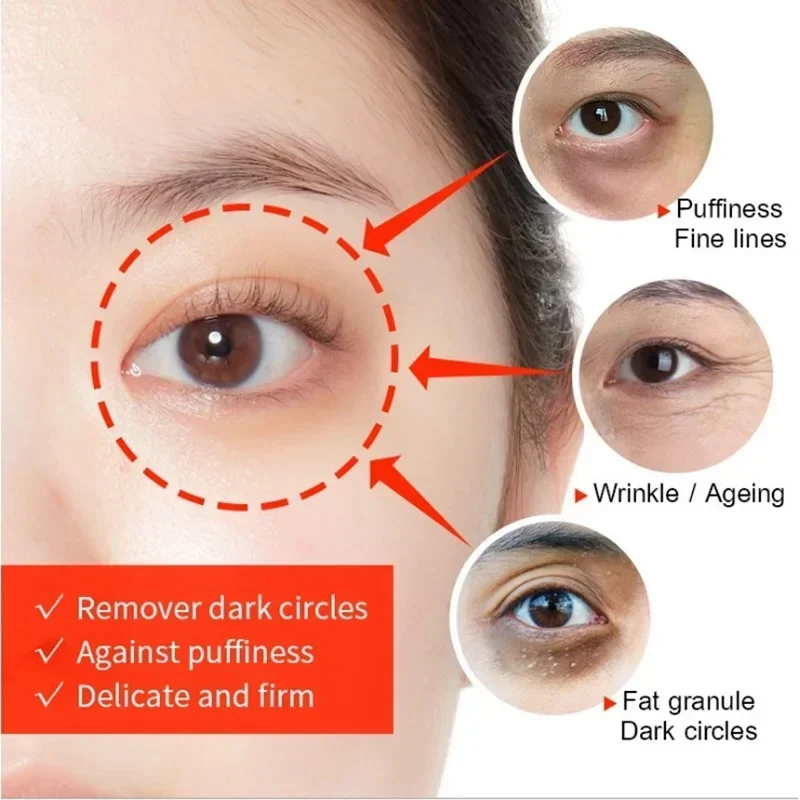 Retinol Remove Eye Bags Dark Circles Eye Cream Fade Fine Lines Anti Puffiness Lift Firming Moisturizing Brighten Eye Skin Care