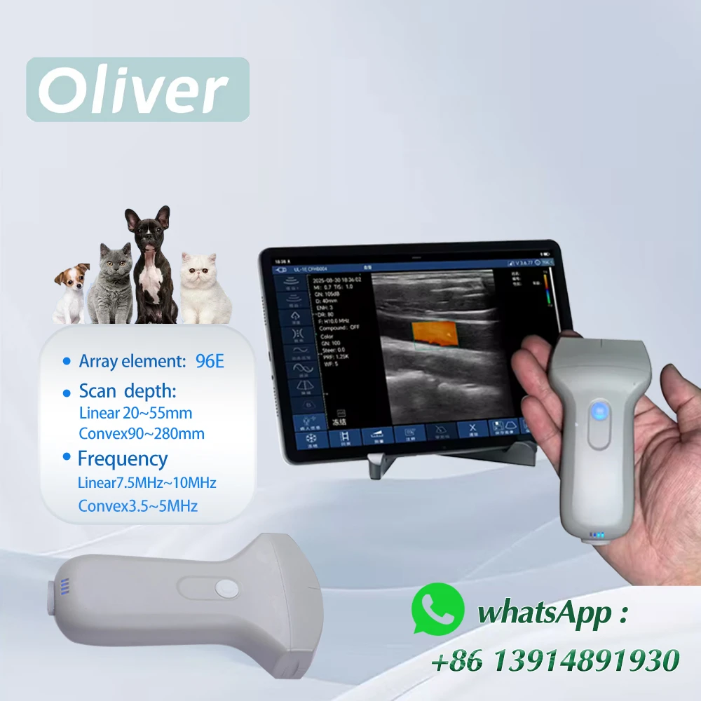 96 Elements Pocket portable Wireless Ultrasound Probe  CP-3L or 3C machine WIFI scanner color doppler linear or Convex
