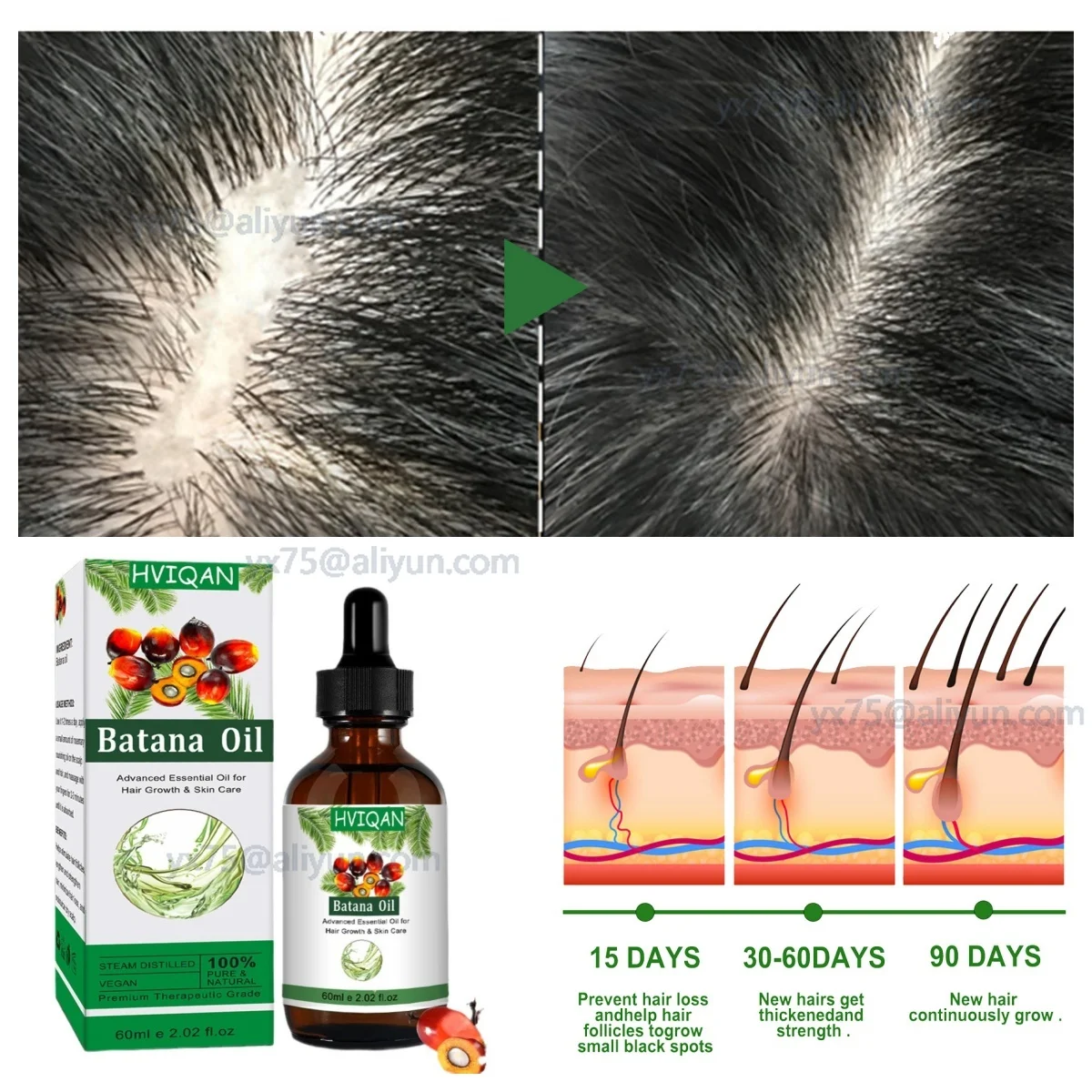 زيت باتانا زيت أساسي متطور لنمو الشعر العناية بالبشرة يحفز نمو الشعر يرطب فروة الرأس Aceite Para El Cabello