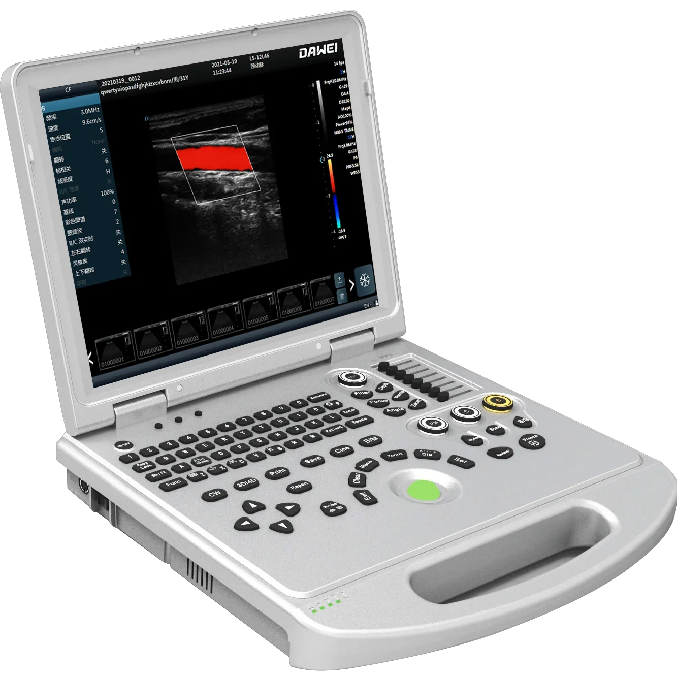 DW-L50 3D4D Real Ultrasound Diagnostic With Good Price Medicalultrasound Scanner Equipmentwith CE&ISO Certificate