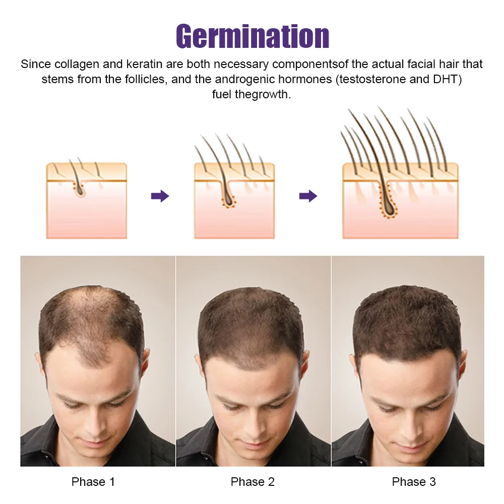 Derma Professional Microneedling Face Massage Roller for Face Beard Growth Hair Growth 0.2/0.25/0.3mm Mesotherapy System Beauty