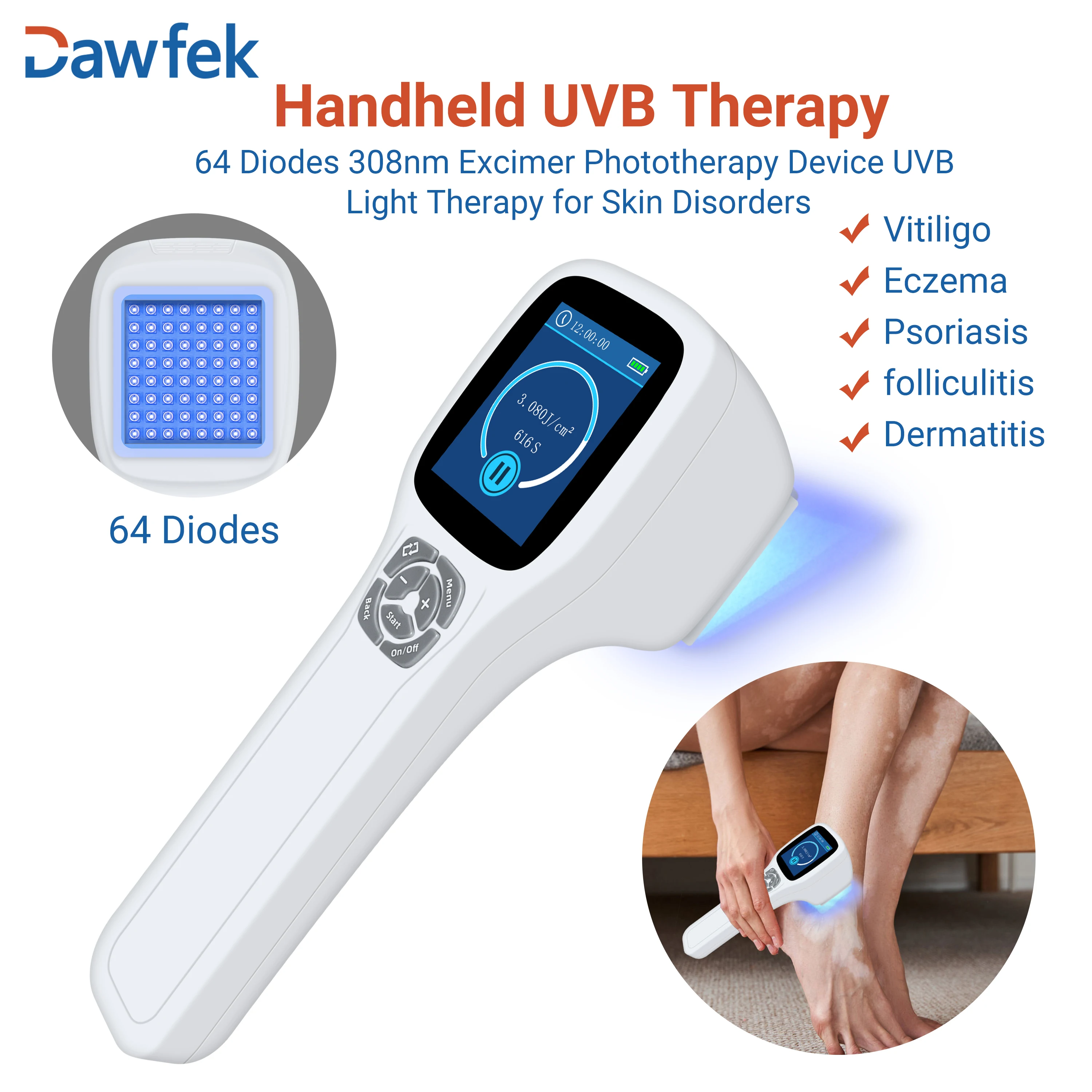 Dawfek Ultraviolet Irradiator for the Treatment of Psoriasis, Dermatitis, Vitiligo 308nm*64 Diodes Large LCD screen