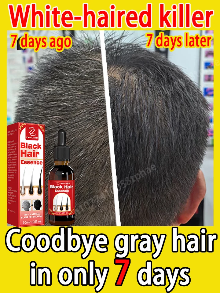 

Men's care, natural anti-gray hair serum, repair gray and black hair, nourishing hair care
