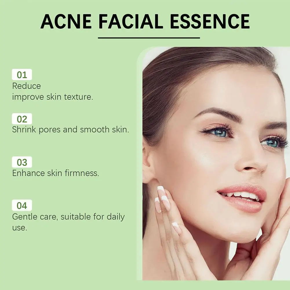 30 мл эффективная жидкость для удаления прыщей, удобная жидкость для удаления прыщей, улучшение прыщей, удобный раствор для восстановления лица, средства по уходу за кожей