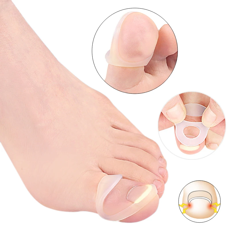 

15Pcs Silicone Feet Care Gel Ingrown Correction Invisible Ingrown Toe Nail Elastic Straighter Clip Brace Pedicure Protector