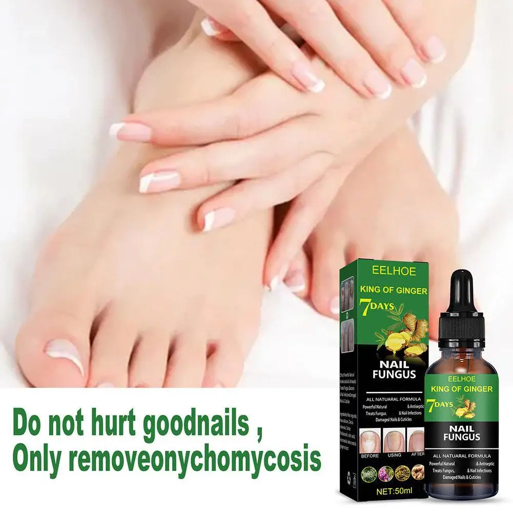 Fungal Nail Treatment Essence Oil เชื้อราเล็บเลเซอร์อุปกรณ์ซ่อมเล็บเท้าเล็บขิง Treatment มือเท้า Essence Liquid