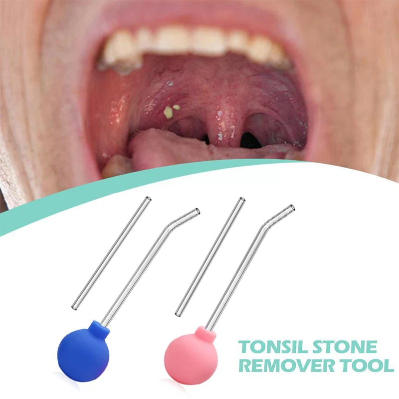 Strumento di rimozione della pietra del Tonsil strumento di rimozione dello stile manuale strumento per la pulizia della bocca cera per le orecchie Tonsil Stone Suction Ball detergente manuale per lo stile