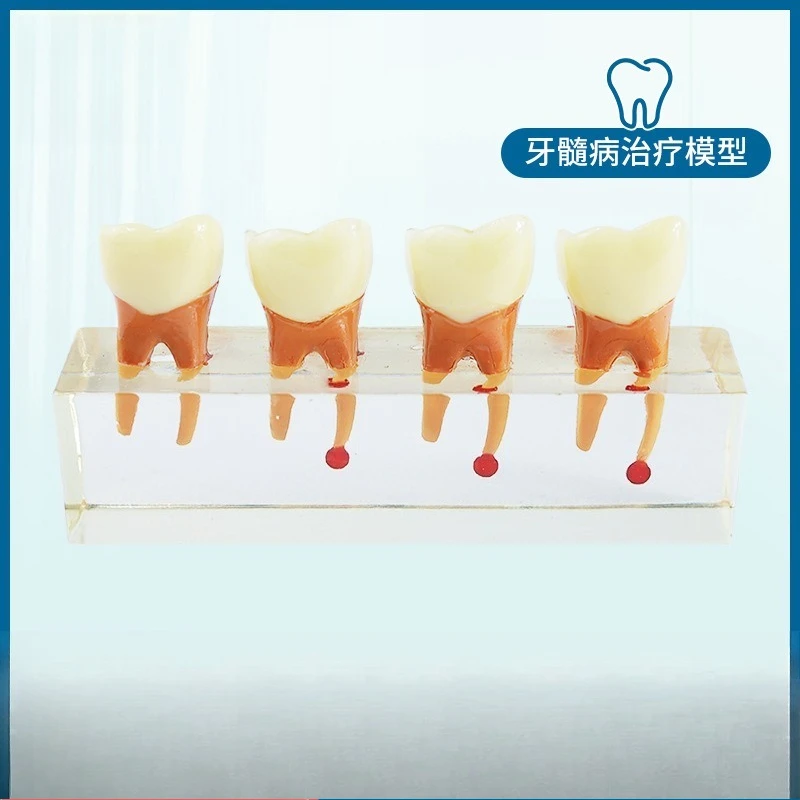 Root canal endodontic therapy model teaching dental implant restoration pathological model doctor-patient communication model