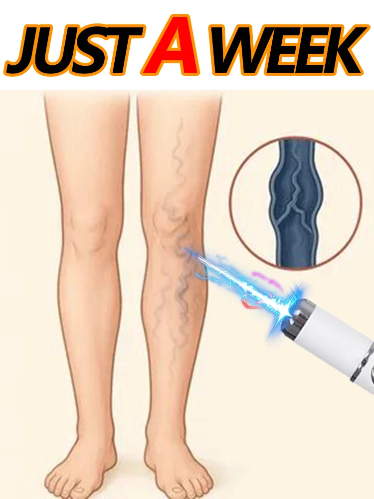 

Ручка с синим светом 2025 года. Приходите всю вену. Горячая продажа в течение 7 дней.