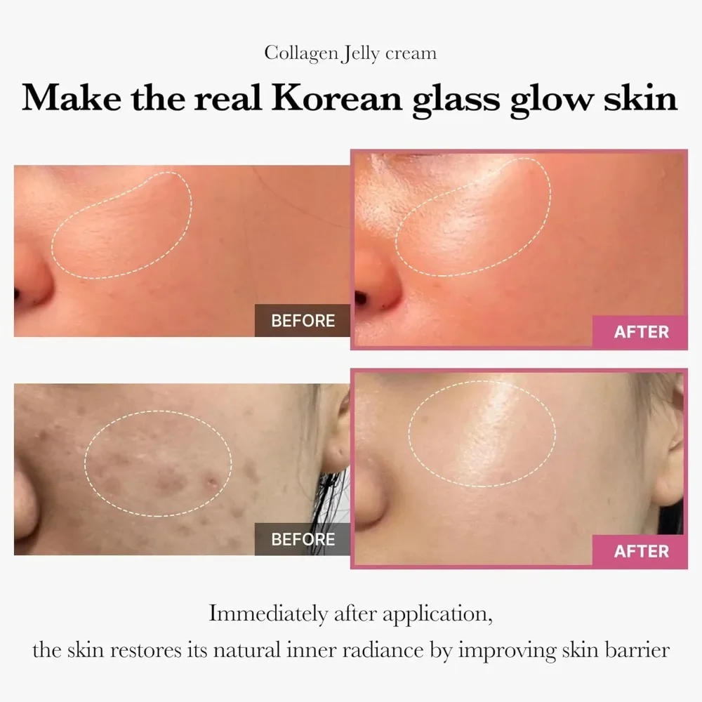 100g Jelly Face Cream Collagen Soft SPA Nourishing Moisturize Face Shrinks Pores Remove Comedones Jelly Essence Korean Skin Care