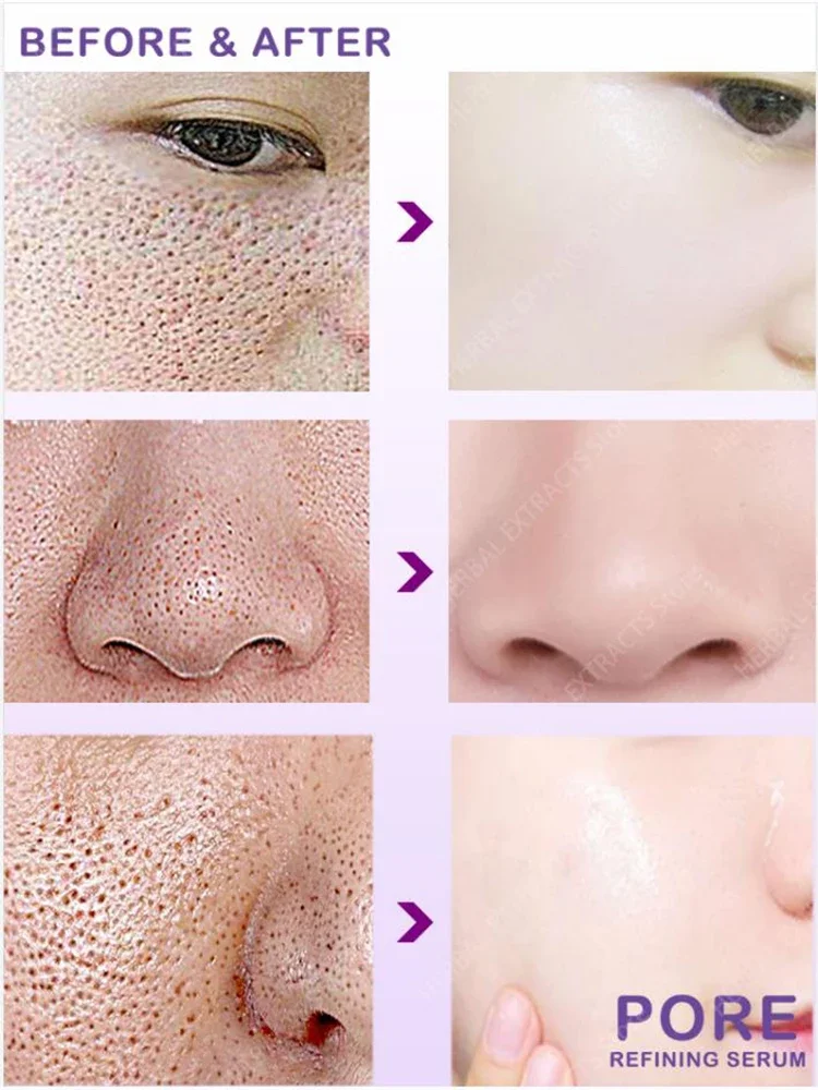 Pore Shrinking Serum Cream Firming Face Pores Shrink