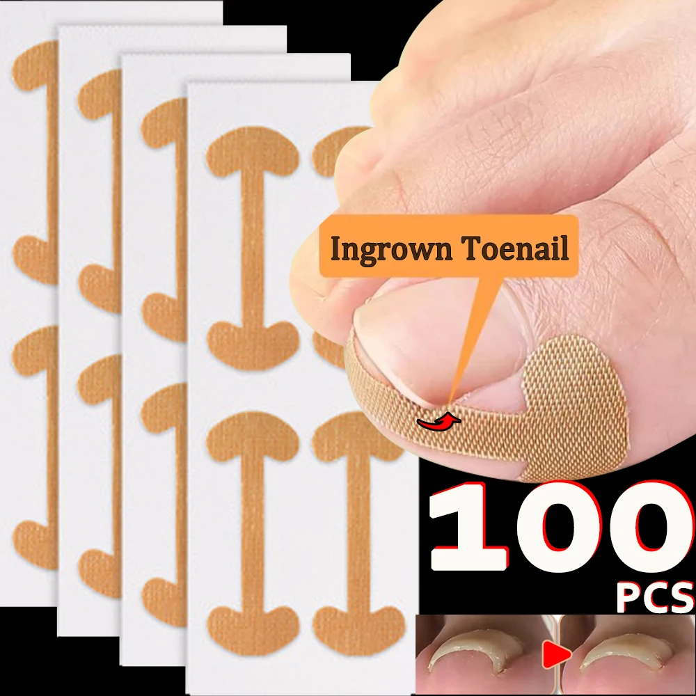 100pcs Nail Correction Stickers Professional Painless Ingrown Toenail Correction Strips Waterproof Breathable Treatment Pedicure