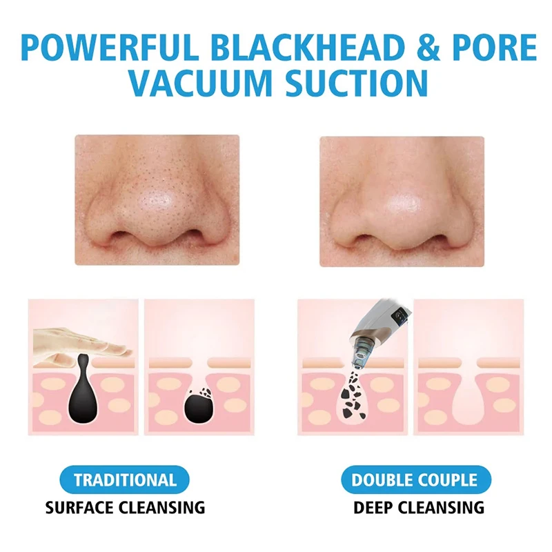 6 Pieces  Electric Blackhead Remover Portable USB Facial Pore Cleaner Spot Acne Pimple Black Head 3 levels Clean Beauty Machine