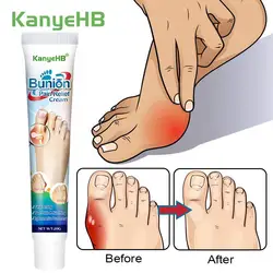 1Pcs Gout Medicine Cream Arthritis Pain Relief Health Care Herbal Treatment Rheumatism Joint Fingers Toes Swelling Ointment G019