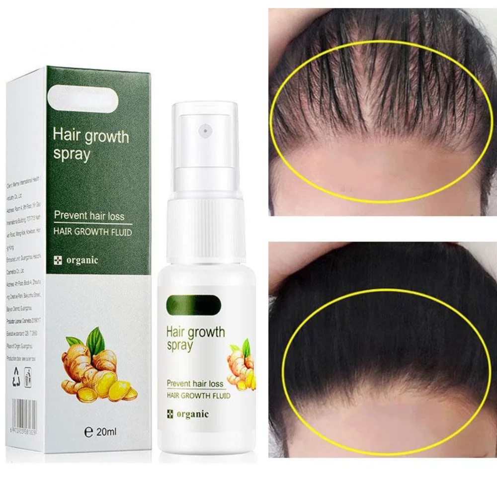 

Ginger Hair Growth Spray Serum For Anti Hair Loss Essential Oil Products Fast Treatment Prevent Hair Thinning Dry Frizzy Repair