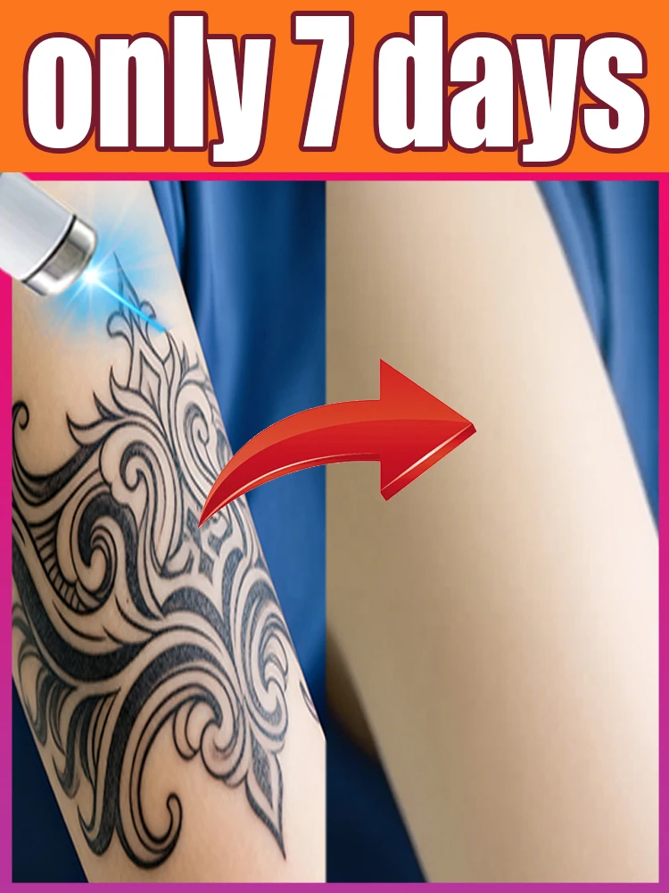 

ₜₐₜₜₒₒ ₗₐₛₑᵣ ₚₒᵢₙₜₑᵣ ₜₕᵢᵣd gₑₙₑᵣₐₜᵢₒₙ ᵦₗᵤₑ ₗᵢgₕₜ ₙₑw ᵤₚgᵣₐdₑ