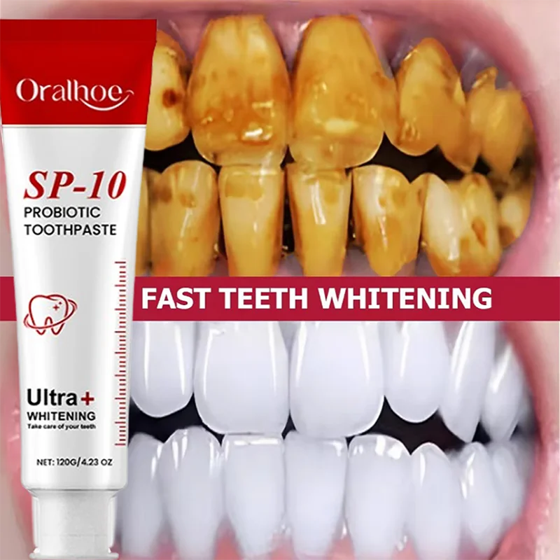 120g SP-10 Probiotic Toothpaste Remove Plaque Stains Whiten Tooth Fresh Breath  Oral Hygiene Clean Teeth Care Management Product