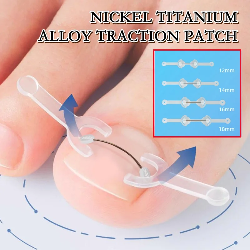 Ingrown Toenail Correction Tool Ingrown Toe Nail Treatment Elastic Patch Sticker Straightening Clip Brace Pedicure Tool