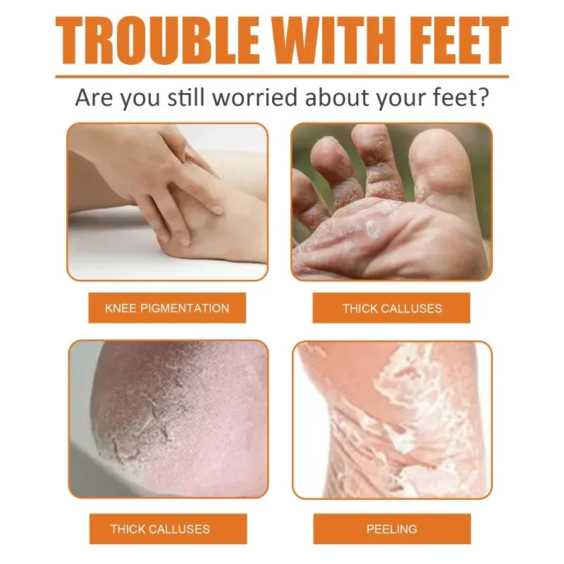 Foot Peeling Spray Callus Dead Skin Remover Heel Dry Cracked Blister Repairing Pedicure Exfoliating Nourishing Foot Care 30ml