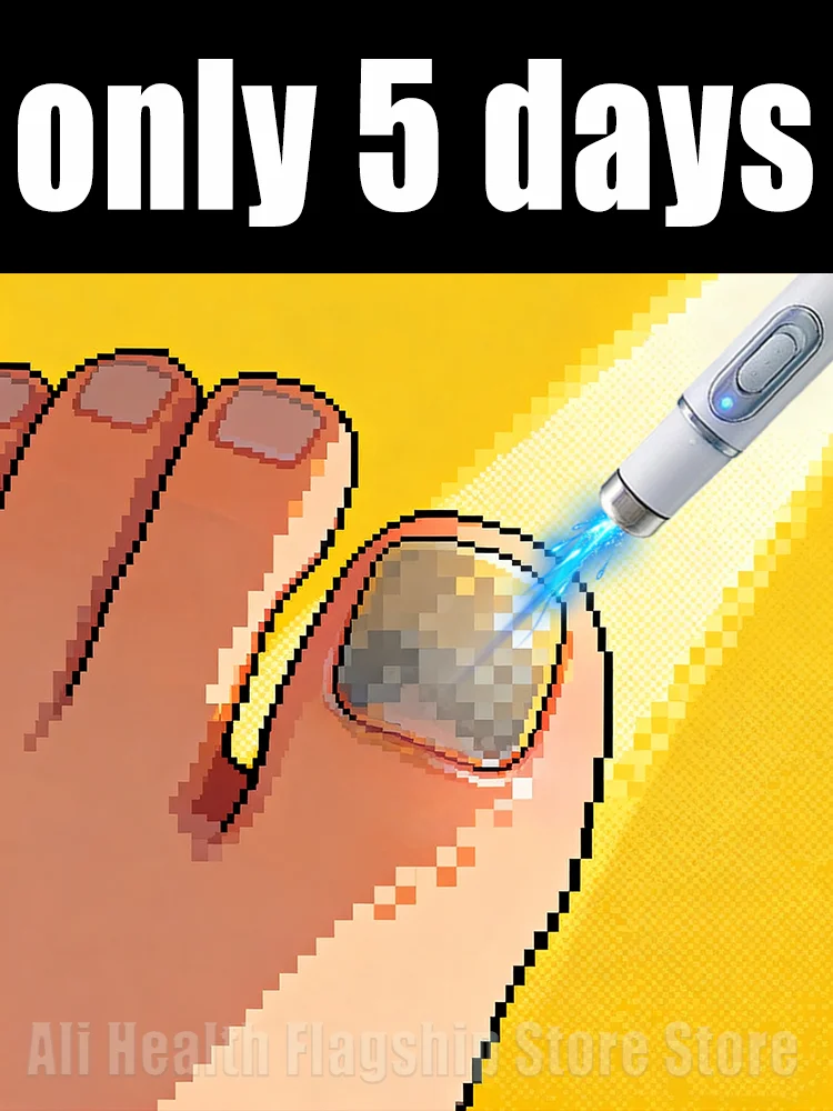 

2025 Hot Sellers: Nail Cleaning Tools, Blue Light Laser Tools Root Repair Upgraded to Second Generation