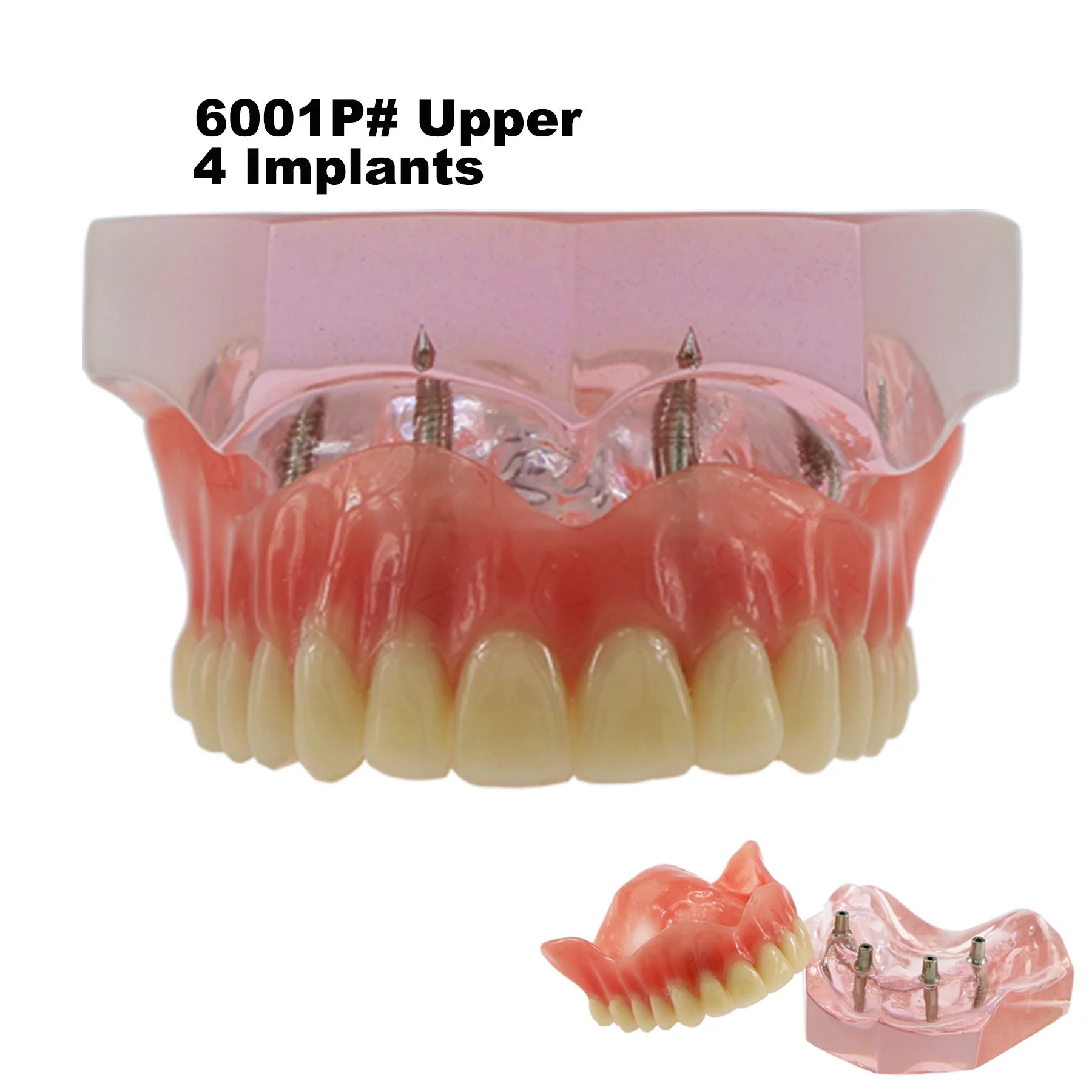 Implant dentystyczny Typodont Model zębów Overdenture 2 4 implanty Superior górna dolna gorsza przywrócenie Demo do nauki