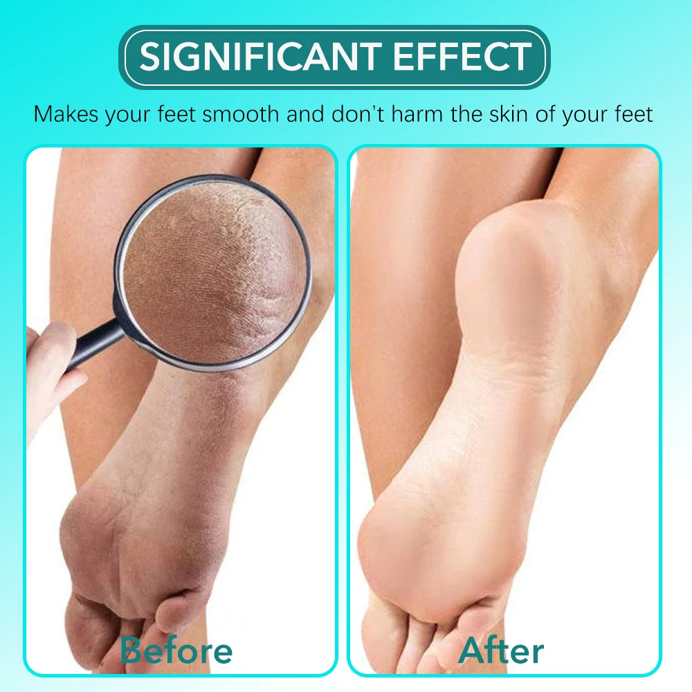 Ensemble de limes de pieds en verre, dissolvant de callosités du talon, soins de la peau morte, outils professionnels de manucure et de pédicure, 2 pièces/ensemble