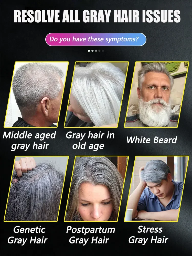 صابون أسود قاتل الشعر الأبيض، يزيل الشعر الرمادي ويعيد لون الشعر الطبيعي في أسبوع