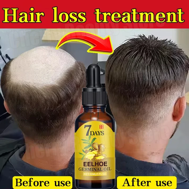 

Fast Ginger Hair Growth Serum Roots Grow Anti Hair Loss Hair Regrowth Serum Scalp Damaged Repair Nourish Care Products Women Men