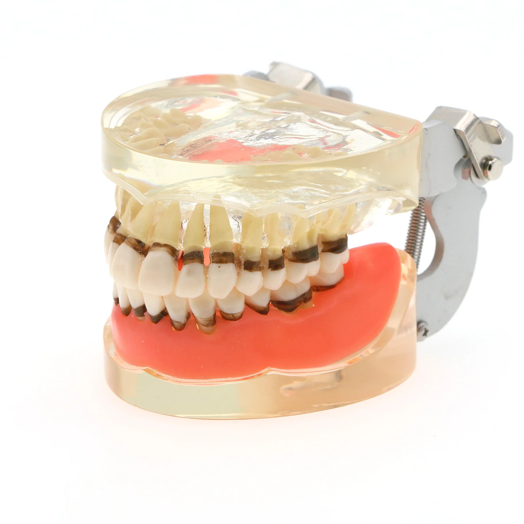 Dentistry Teeth Model Dental Periodontal Disease Pathological Teaching Model Demonstration For Dentist Teaching Model