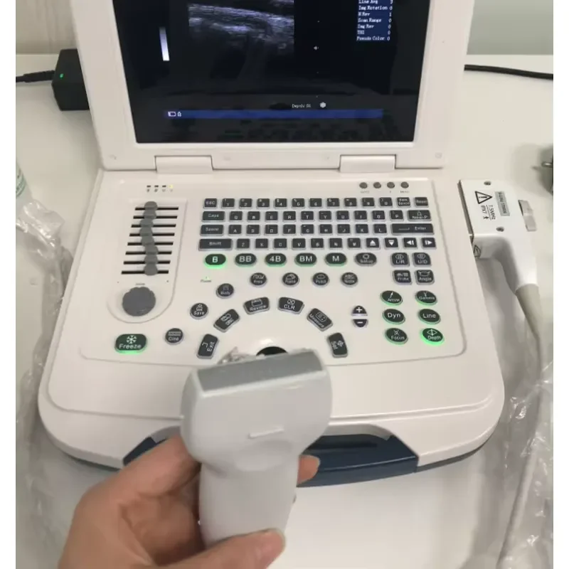 Hot Sale OSCAT Veterinary Equipment Veterinary Ultrasound Machine Portable 12 Inch LCD Digital Imaging Rechargeable Battery