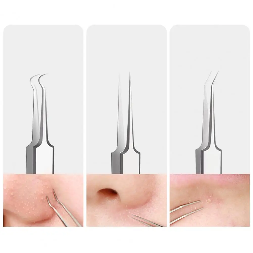 Comedondrukker Kit Roestvrijstalen Acne Naald Pincet Set voor Gezichtsreiniging Gereedschap Professionele Puistje Popping Tools