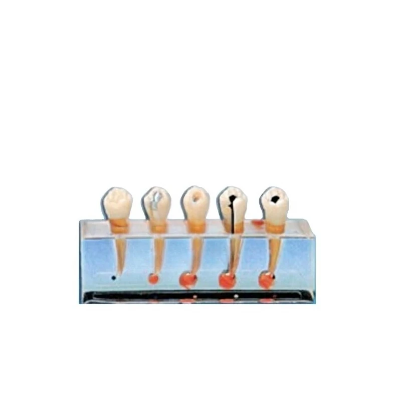 Clinical Model of Endodontics Medical Teaching Model Dental Model Teeth