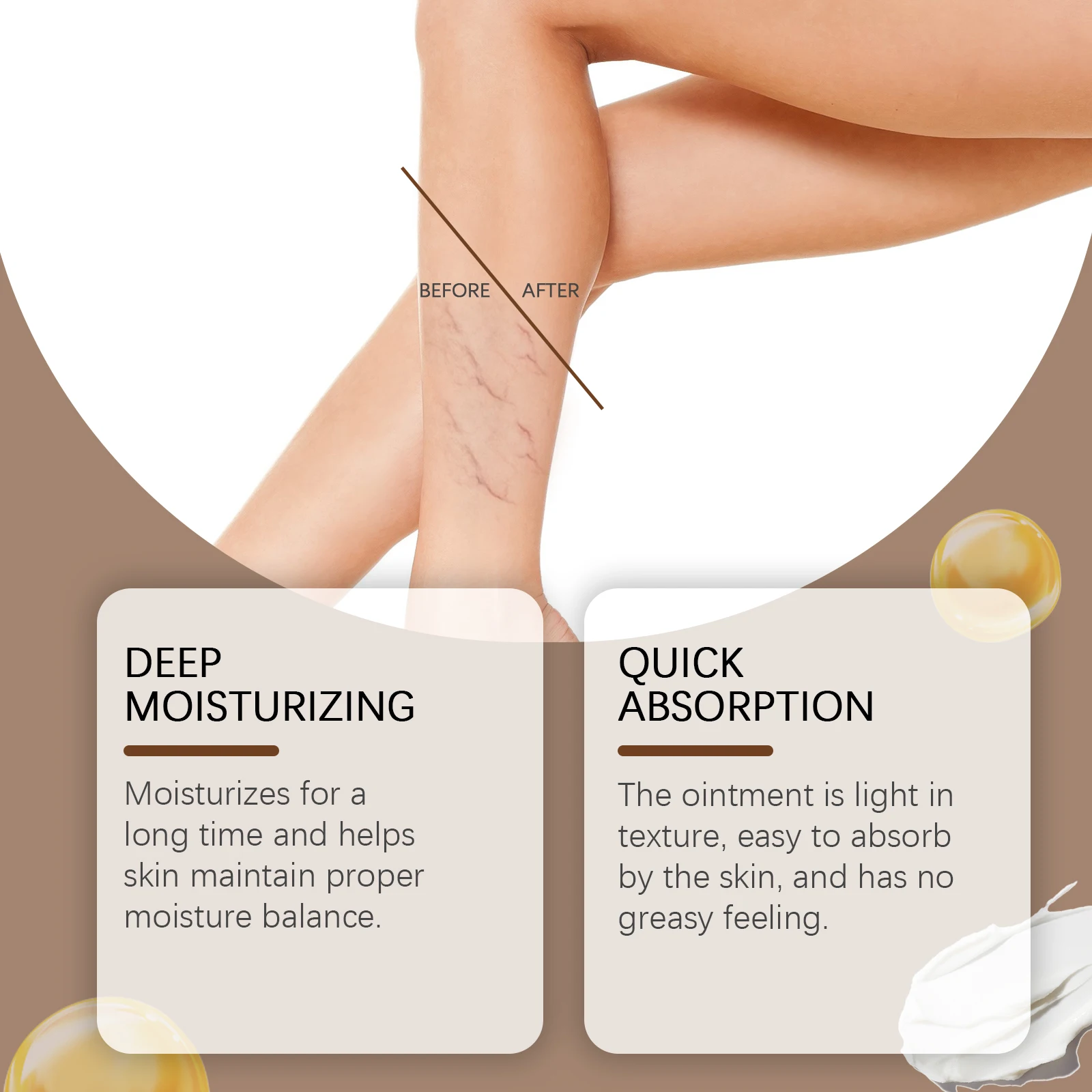 Varicose Veins Relief & Leg Moisturizing Cream – Soothes Spider Veins, Phlebitis & Vasculitis, Improves Circulation, Nourishes Dry Skin, Daily Massage Care Ointment for Tired Legs