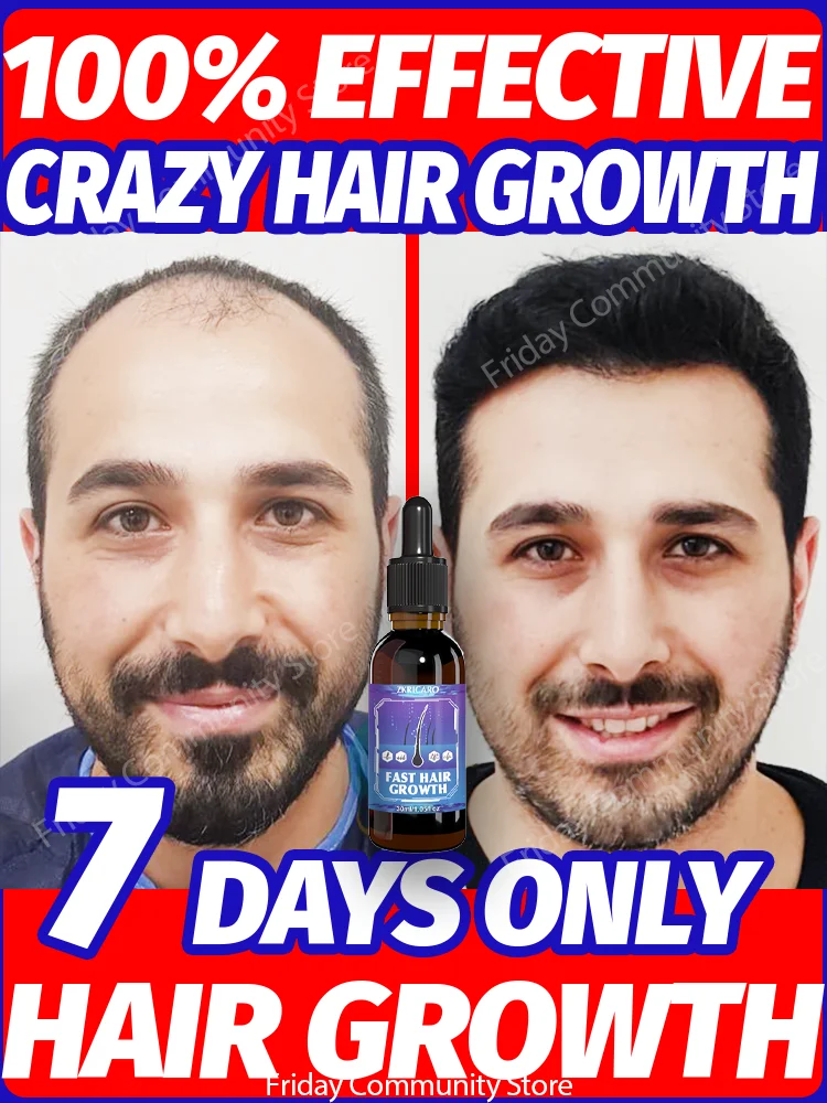 

98% of buyers buy again, have more and more hair, say goodbye to baldness, thick hair,Hot selling product