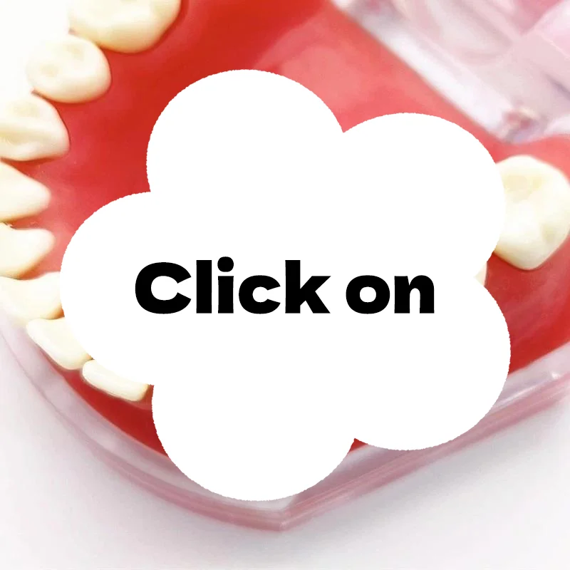 

Зубной имплантат, параллельный штифтовый калибр, медицинский локатор из нержавеющей стали, руководство по установке зубного имплантата, линейка для поиска