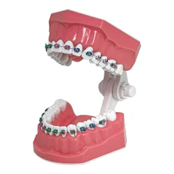 Dental Typodont Orthodontic Teeth Model 1:1 Standard Demo Teach Study With Archwire Ligature Ties Metal Brackets Buccal Tubes