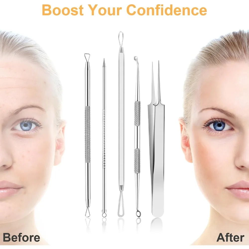 Professional 9PCS Blackhead Remover Pimple Popper Tool Kit Comedone Extractor with 16 Precision Heads 2 Tweezers 304 Stainless Steel Acne Zit Removal for Face Nose Home Esthetician Use Leather Case Included