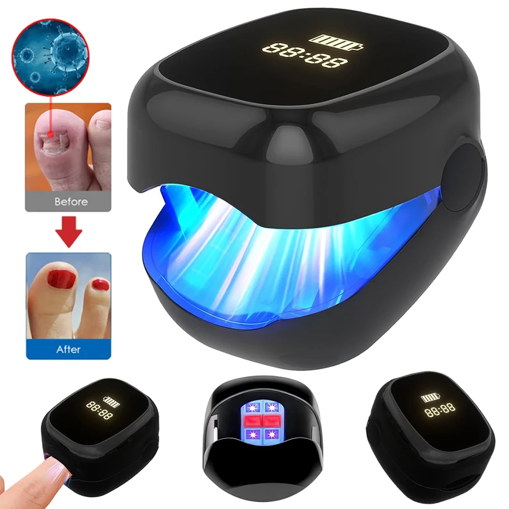 

Nail Fungus Laser Treatment Device Fingernail Fungus Treat Onychomycosis Therapy Effectively Remove Onychomycosis Grow Toe Nail
