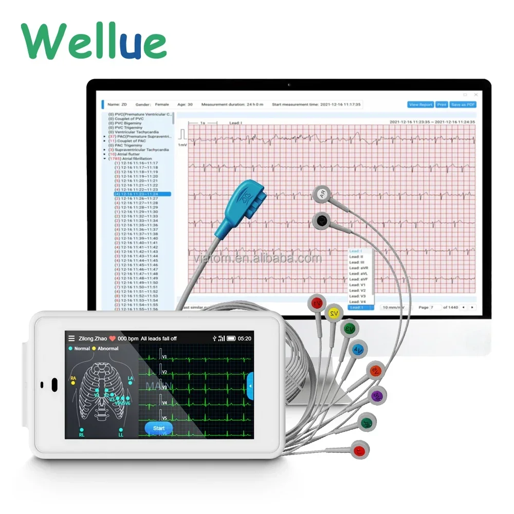 Wellue PCeccg 500 Portable eccg Machine 12 Leads eccg Holter Recorder Electrocardiogram Wireless eccg